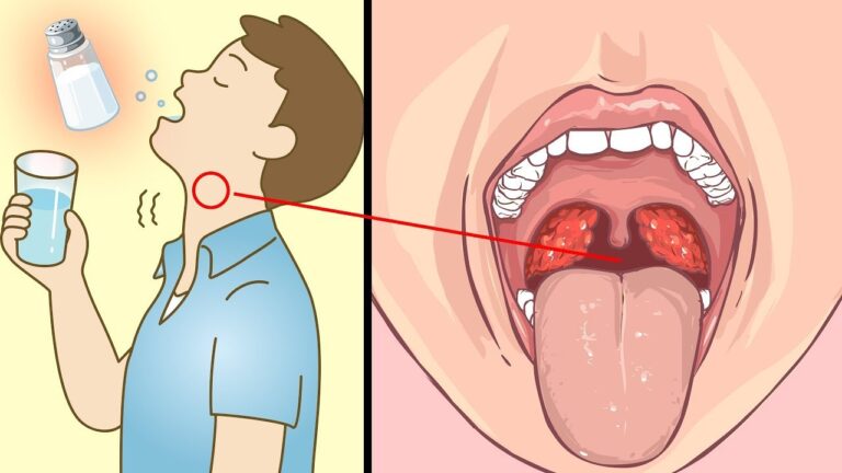 7 vantaggi sorprendenti dei gargarismi con acqua salata in una settimana!