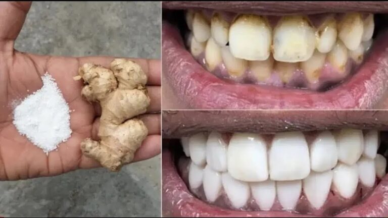 Scopri 5 trucchi per avere denti bianchi in pochi minuti!