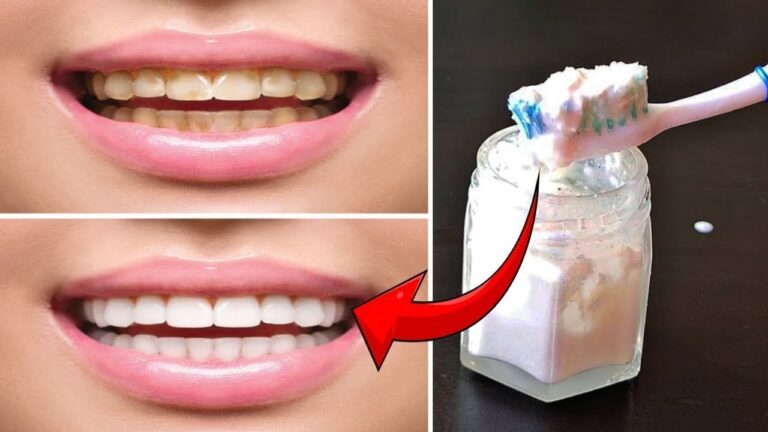 5 trucchi per far tornare i tuoi denti bianchi e luminosi!