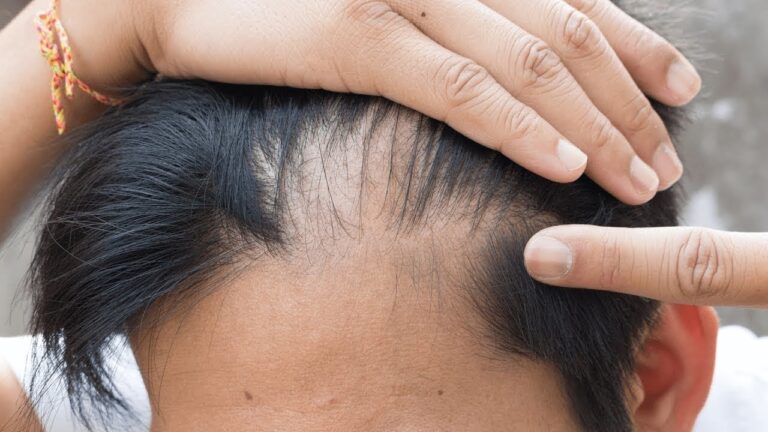 5 motivi per cui l’olio di ricino trasforma i tuoi capelli! Scopri il segreto!