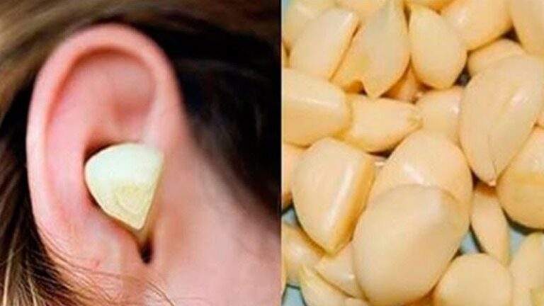 5 motivi per cui il rimedio della noce d’aglio è sorprendente!
