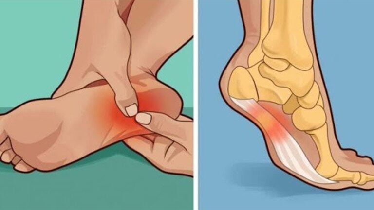 6 soluzioni efficaci per alleviare il dolore al tallone al mattino