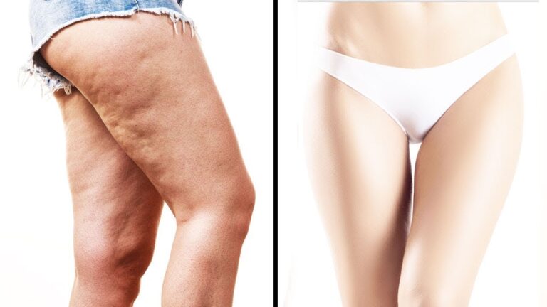 Scopri 5 esercizi per avere cosce perfette e toniche!