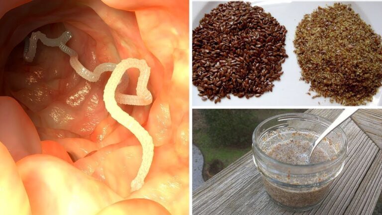 5 metodi naturali per liberarti dei parassiti intestinali subito!