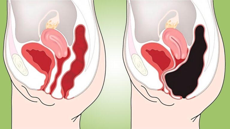 10 Smoothie Naturali per un Colon Pulito e Sano a Casa