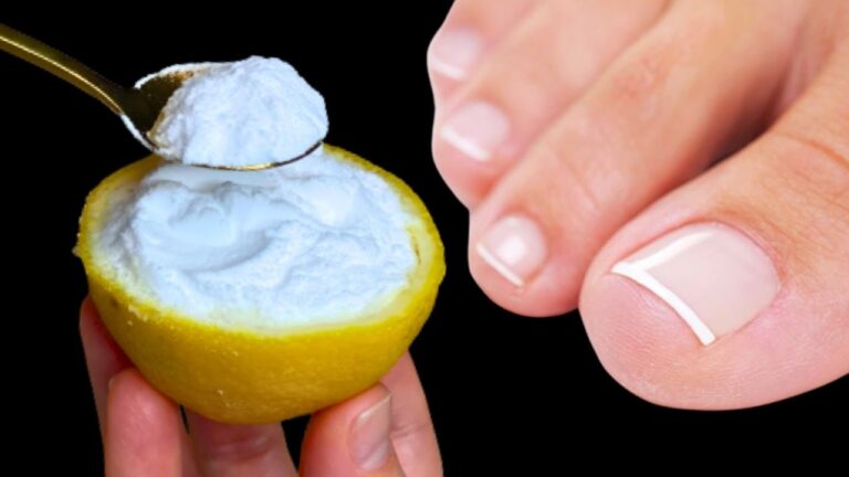 Rimuovi il fungo delle unghie in 7 giorni con questo rimedio naturale sorprendente!