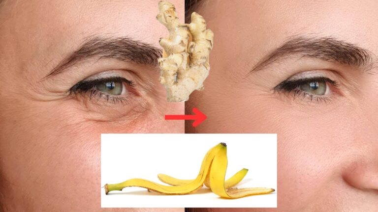5 motivi per usare la buccia di banana nella tua routine di bellezza!