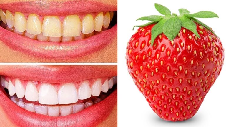 Sorriso splendente: 5 trucchi per sbiancare i denti in pochi minuti!