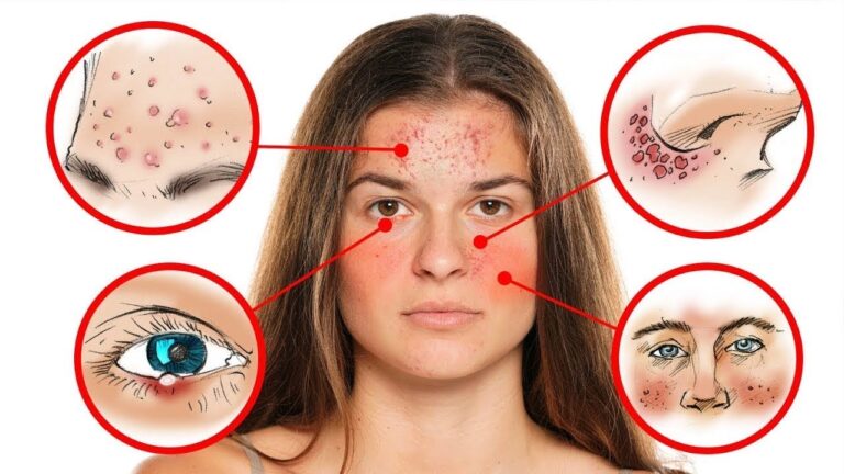 10 segni sul tuo viso che rivelano problemi di salute da non sottovalutare