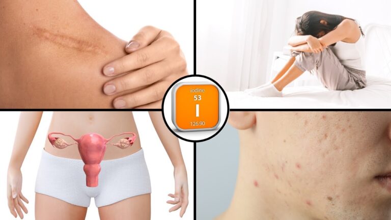Scopri 5 sorprendenti benefici del Jodo che non conoscevi!